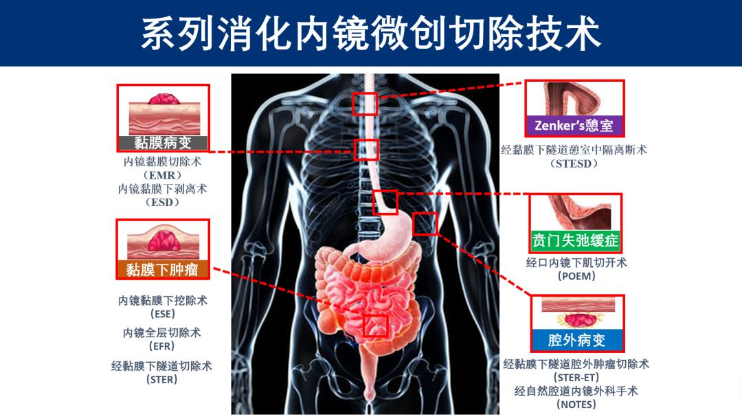 中国经济周刊：2024香港今晚开特马-让世界内镜看中国，才是真正的终极目标！